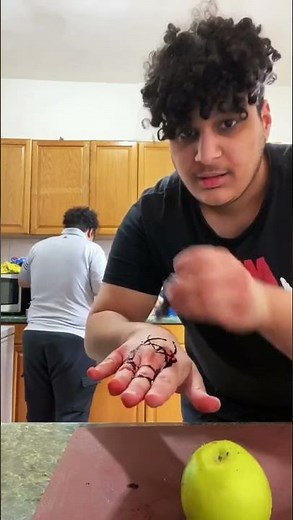 HAND GETS CUT OFF PRANK 😱 #shorts