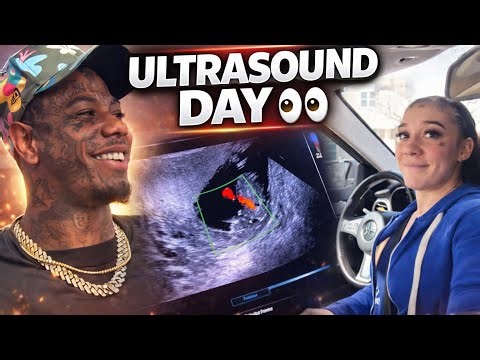 Blueface & Nevaeh Ultrasound Day 👀 Black Eye Update Has Fans Talking