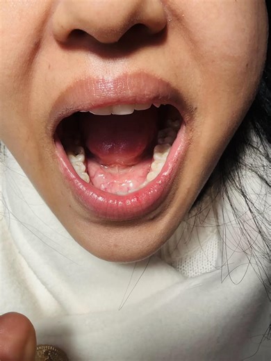 #teeth 🦷 operation 🥹