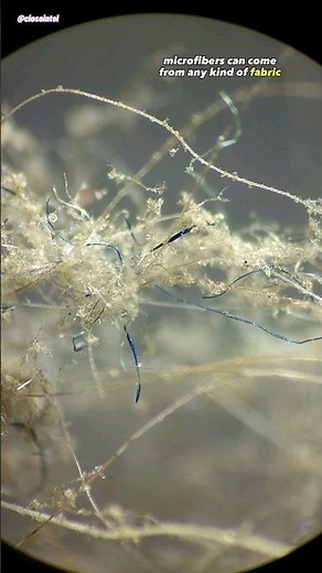Dust From Air Purifier Under Microscope