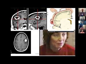 Medical Student Lecture Series - Brain Tumors