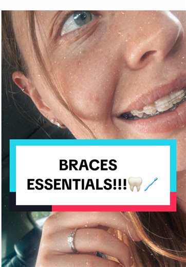 Essential Tips for Surviving Adult Braces