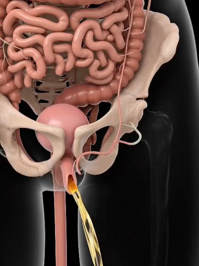 How Urine Leaves the Body | 3D Medical Animation Description: A simple 3D explanation of how urine moves through the body and exits naturally. Educational purpose only. #MedicalInfo #3DAnimation #HumanBody #UrineFlow #healtheducation