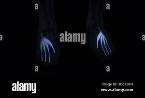Extensor digitorum brevis muscle in human body. X Ray. Loop