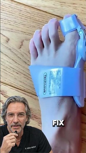 Do Bunion Correctors Actually Work