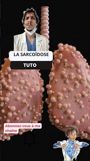 Understanding & Preventing Sarcoidosis #tutorial #tips #tuto #reels #best #health #fyp #ide