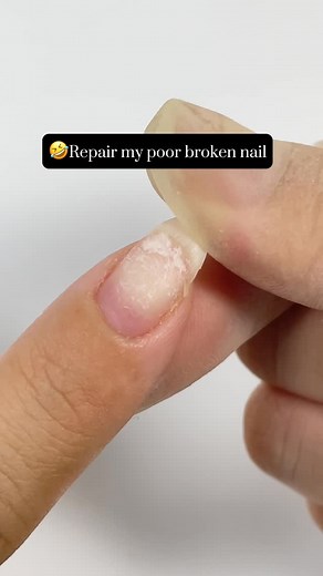 VARNAIL on Instagram: "✨Easy Repair Broken Nail with our Cracked Nail Repair Kit! 🛒(varnail.com) Cracked Nail Repair Kit Fiber Repair Gel 🛒🛒🛒 Shop More Nail Supply at varnail.com or in our bio link 💝💝💝 PLEASE FOLLOW US TO GET THE TRENDY NAIL TECH! #nails #chromenails #cateyegel #naildesigns #nailart #ombrenails #nails💅 #nailsalon #nailbeauty #summernails #nailbeginner #frenchnails #nailinspo #nailmagazine #shortnails #fashion #nailtrends #holidaynails #magneticgelpolish #nailtutorials #g