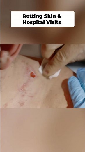 INJURY: 1,000 mile World Record Swim around Iceland