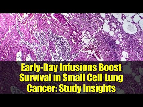 Early-Day Infusions Boost Survival in Small Cell Lung Cancer: Study Insights