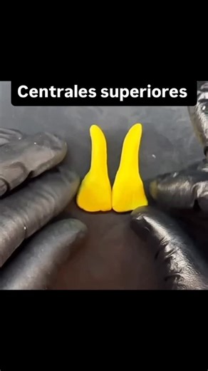 PuntoDental.Academy on Instagram: "🌼 La Danza de la Simetría Dental ¿Sabías que la perfección de una sonrisa está escrita en las leyes de la naturaleza? Observa cómo un simple cilindro de material se desdobla en las dos ondas de vida que dan origen a la anatomía de un diente central. Es el principio de la simetría bilateral y la geometría divina que rige toda forma biológica. Esta es la esencia de la Técnica de La Cinta: dominar lo invisible para crear sonrisas visibles y perfectamente armónica