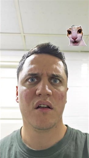 My bro's dentist is literally crying... 💀🦷 #funny #comedy #relatable #viral #memes #trendingshorts