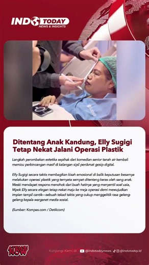 Ditentang Anak Kandung, Elly Sugigi Tetap Nekat Jalani Operasi Plastik