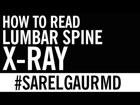 How to Read Lumbar Spine X-Ray | Anatomy