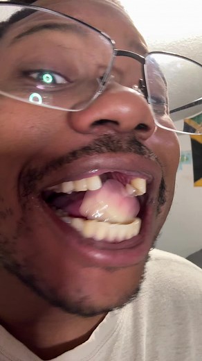 Relax Your Jaw with ASMR Teeth Clicking Sounds