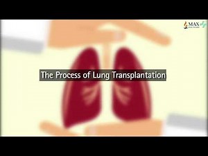 The Process of Lung Transplantation and Combined Heart-Lung Transplant