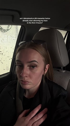 ¿El botox en el masetero ya está funcionando?