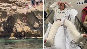 Girl breaks both legs in cliff diving plunge