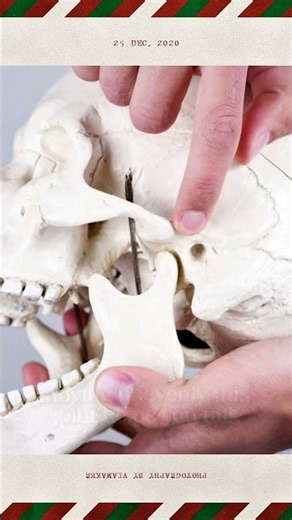 Why Does Your Jaw Click When You Open Your Mouth? 🦷😳 #dentalhealth