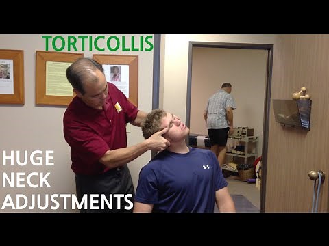 EXTREME neck pain & TORTICOLLIS are GONE with HUGE NECK ADJUSTMENT's ‪@SoCalChiropractic‬