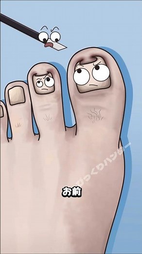 巻き爪・爪囲炎のNG爪切り