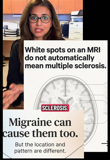 Not every white spot on MRI means multiple sclerosis. Migraine can cause white matter lesions too — but the location and pattern are very different. In MS, lesions tend to appear in specific regions of the central nervous system: • Periventricular • Juxtacortical (touching the cortex) • Infratentorial (brainstem/cerebellum) • Spinal cord Neurologists diagnose MS through pattern recognition, not by simply counting spots. White matter lesions alone do not diagnose multiple sclerosis. #Neurology #M