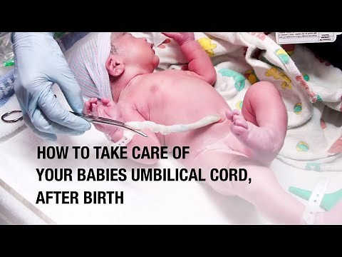 How to take care of your babies umbilical cord, after birth