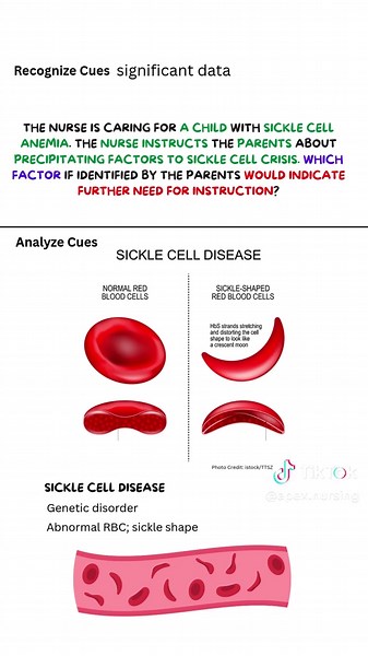 Sickle Cell Anemia Practice Questions for Nursing Students