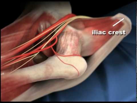 Hip Anatomy | Anterior Approach to Hip Replacement