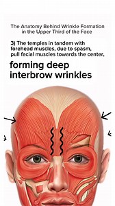 24K views · 207 reactions | ANATOMY OF WRINKLE FORMATION IN THE UPPER...