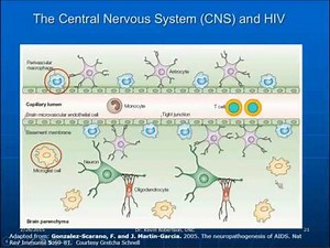 Kevin Robertson, Ph.D. - HIV Associated Neurocognitive Disorders Global Findings