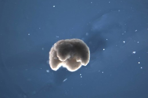 Biobots: así son los robots vivos hechos con células de rana que prometen revolucionar la ciencia moderna