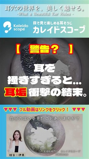 【警告？】耳を掻きすぎると…耳垢衝撃の結末。
