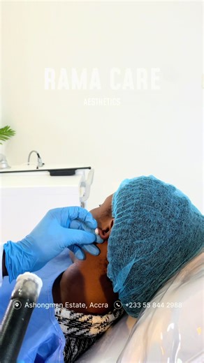 Ear Keloid Treatment: Before and After Cryotherapy