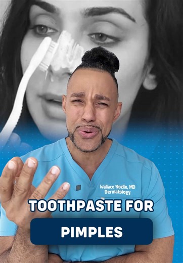 #Toothpaste on #Pimples ? Y’all STILL doing that?🧐 | Toothpaste