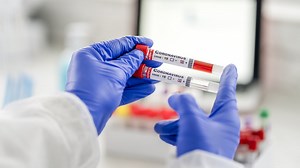 Covid-19: 1,296 more cases, six further deaths