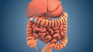 Medical concept of capsule endoscopy technique