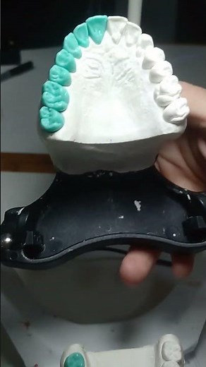 morfologia e anatomia dentária enceramento diagnóstico.