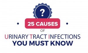 Main UTI Causes. What makes you prone to UTIs? - Stop UTI Forever