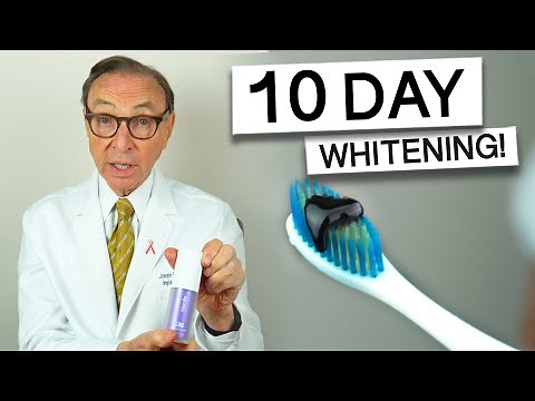 Hismile Purple Toothpaste for 10 Days - Dentist Review! #teethwhitening