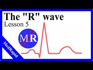 The R wave - EKG basics