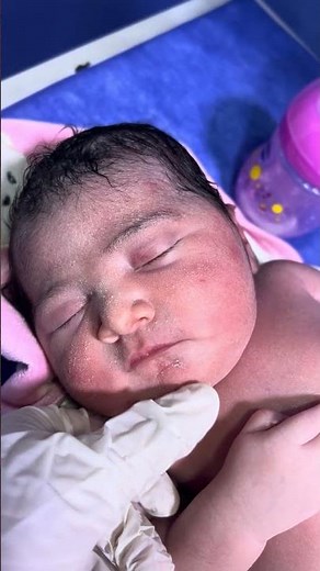 #babyfirstminutes #love #baby Chubby baby after taking his first bottle 👶💓🍼