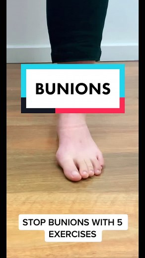 Prevent and Treat Bunions with these 5 Simple Exercises
