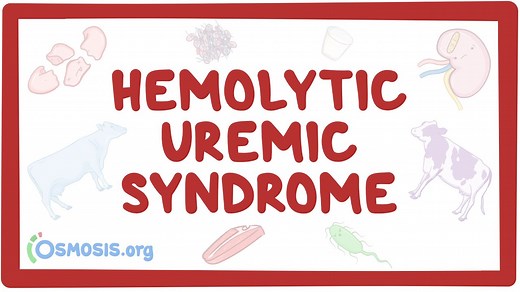 Hemolytic-uremic syndrome: Video, Causes, & Meaning | Osmosis