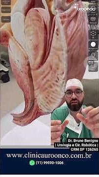 Prostate Anatomy with a 3D model: urine, ejaculation, and symptoms explained. #urology