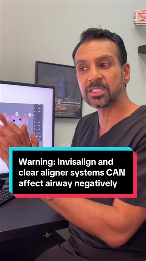Invisalign Effects on Airway Health Explained