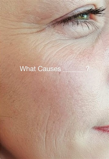 Discover the True Causes of Your Skin Issues