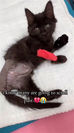 Rusell Praise on Instagram: "Please don't scroll past stay for a minute help recover from my surgery 🙏 😭"