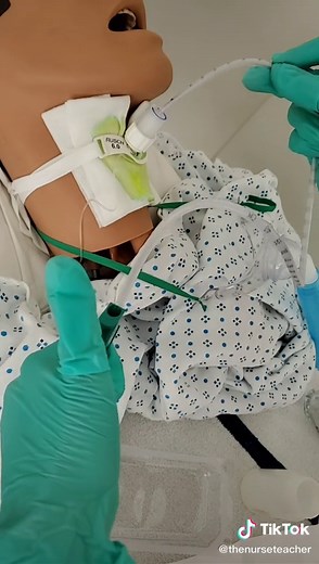 Tracheostomy Suctioning Techniques: A Comprehensive Guide