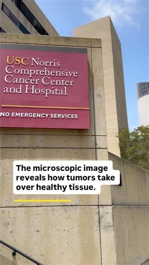 Zooming Into Cancer: What USC Cancer Researchers See Under the Microscope