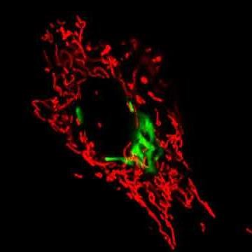 Golgi and Mitochondria Dynamics in Fibroblast Cells Under a Fluorescence Microscope